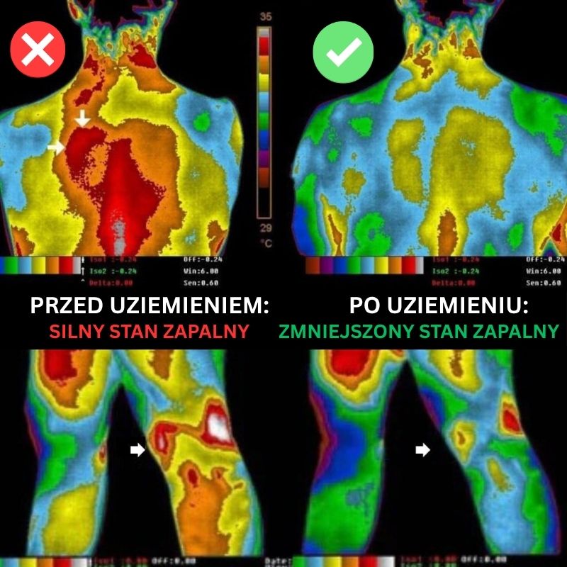 Mata Uziemiająca - Odzyskaj Naturalną Równowagę Organizmu